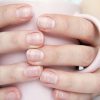 Doença nas unhas